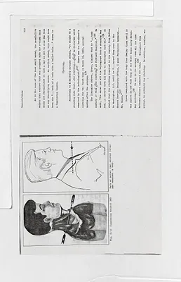 p. 56