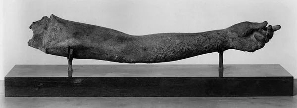 Left Arm