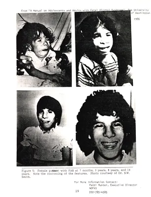 p. 17